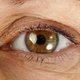 Gusanos en los ojos (Loa Loa): Principales síntomas y tratamiento