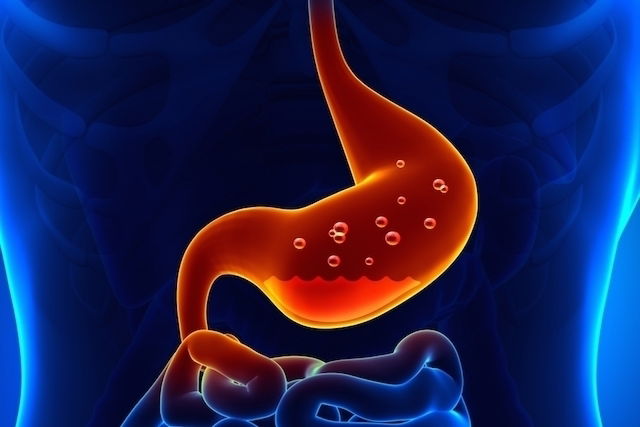 Dispepsia: qué es, síntomas, causas y cómo tratarla - Tua Saúde