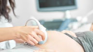 Hidropisia fetal: o que é, sintomas, causas e tratamento