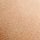 Skin Peeling: 9 Common Causes & What to Do