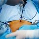 Operación de apéndice (apendicectomía): cómo se realiza y recuperación