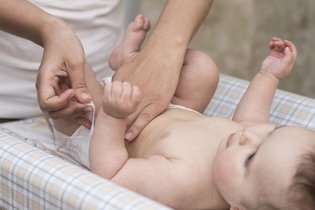 Imagen ilustrativa del artículo Sangre en el pañal del bebé: 7 causas y qué hacer