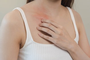 Image illustrative de l'article Démangeaisons des seins : 7 causes principales et que faire ?