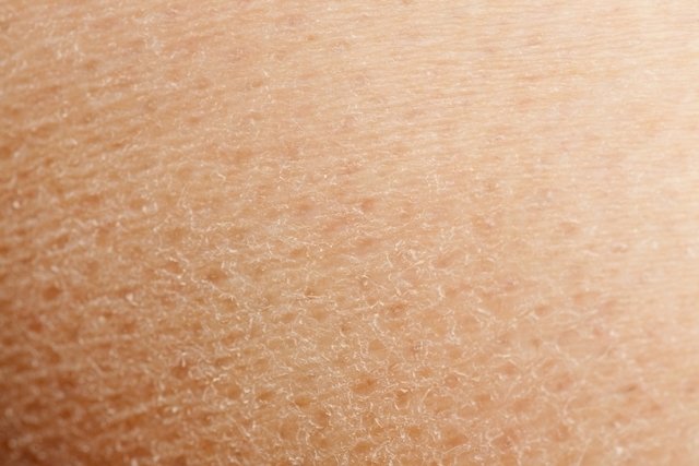 en la piel: 11 causas y hacer
