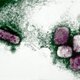 Varíola: o que é, sintomas, transmissão e tratamento
