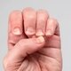 Ridges in Fingernails: 5 Common Causes & What to Do