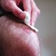 5 passos para cicatrizar uma ferida mais rápido
