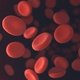 Anemia microcítica: o que é, principais tipos e tratamento