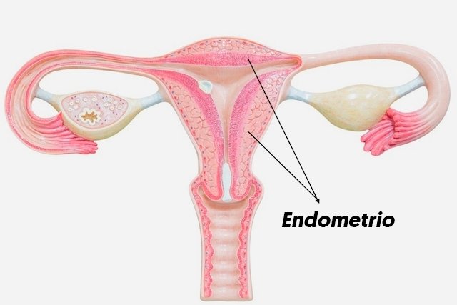 Localización del endometrio