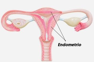 Imagen ilustrativa del artículo Endometrio: qué es, fases y enfermedades que lo afectan