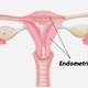 Endometrio: qué es, fases y principales enfermedades que lo afectan