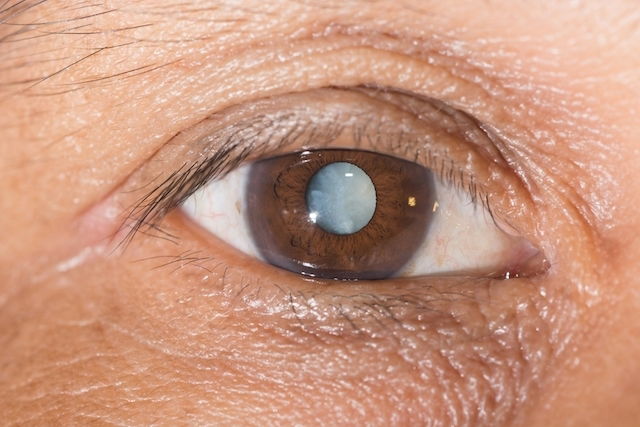 White spot on eye: Causes, symptoms, and treatment