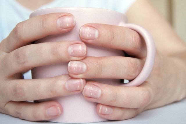The 5 signs in your nails you have a vitamin deficiency - from white spots  to grooves | Express.co.uk