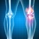 Como tratar uma lesão nos ligamentos do joelho