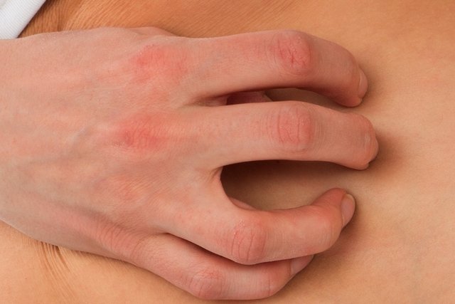 Resultado de imagem para 6 principais causas de coceira na pele e como tratar