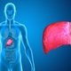 Transplante de fígado: quando é indicado e como é a recuperação