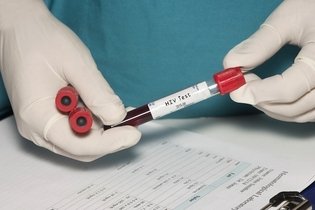 Imagem ilustrativa do artigo O que fazer em caso de suspeita de HIV