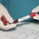 O que fazer em caso de suspeita de HIV