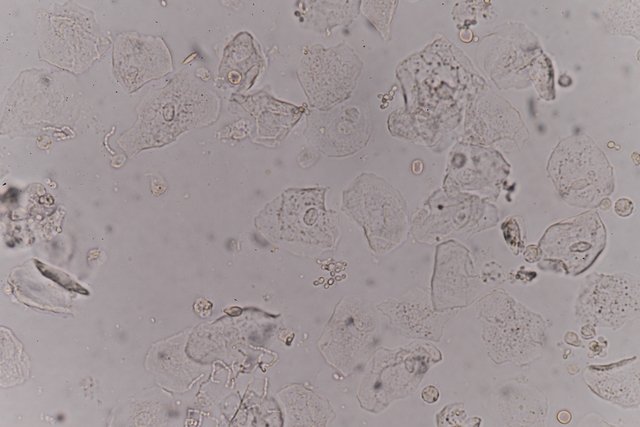Células epiteliales en orina: qué son, causas, tipos y valores normales