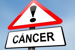 12 signos y síntomas de alarma de cáncer  