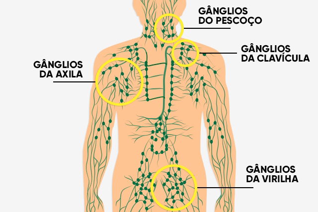 Imagem ilustrativa número 1