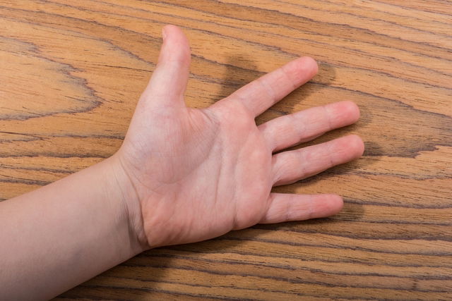 Fenómeno de Raynaud, Síndrome ou Doença de Raynaud