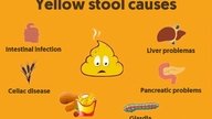 Yellow Poop: 7 Common Causes & What to Do