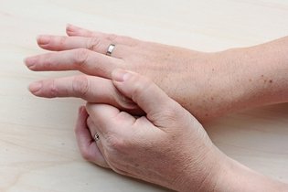 Imagem ilustrativa do artigo Artrose nas mãos e dedos: sintomas, causas e tratamento