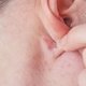 Bulto o bolita detrás de la oreja: 6 causas y qué hacer