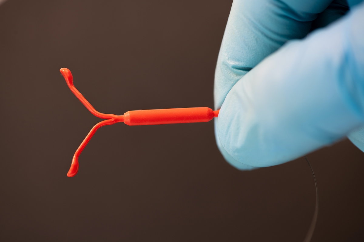 10-frequently-asked-questions-about-the-mirena-iud