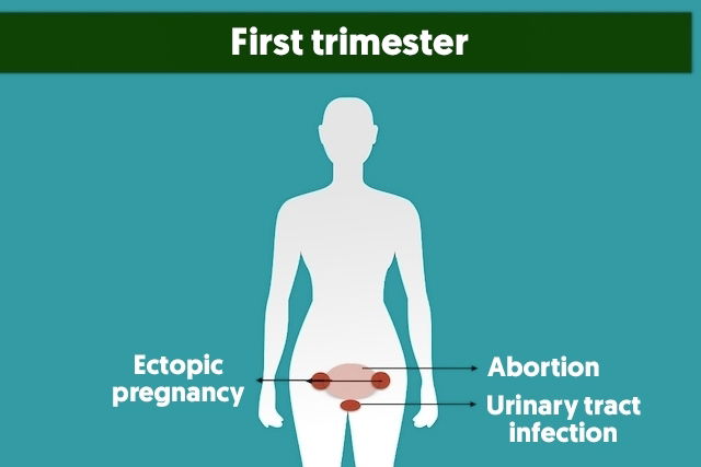 stomach-pain-during-early-stage-of-pregnancy-pregnancywalls