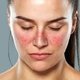 Vermelhidão no rosto: 10 principais causas e o que fazer