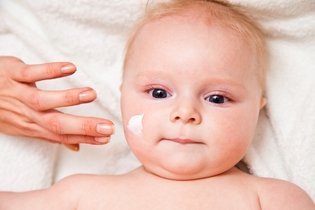 7 problemas de pele comuns no bebê e como tratar