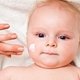 Manchas en la piel de bebés: 7 causas y qué hacer
