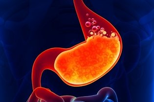 Image illustrative de l'article 7 symptômes de l'ulcère gastrique (et quelles sont les personnes à risque)