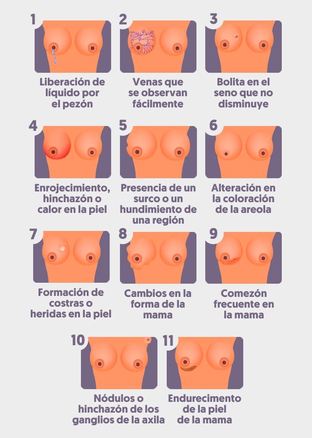 Síntomas de cáncer de mama en mujeres