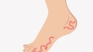 Coceira nos pés: 10 principais causas e o que fazer