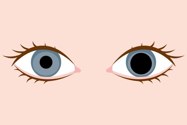 anisocoria definition