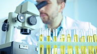 Bacteria in Urine: What Results Mean & Common Causes