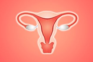 Endometriosis intestinal: síntomas y tratamiento