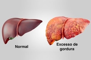 Dor no fígado: 8 principais causas (e como tratar)