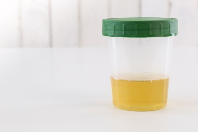 Cloudy Urine During Pregnancy