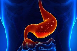 Úlcera gástrica: o que é, sintomas, causas e tratamento