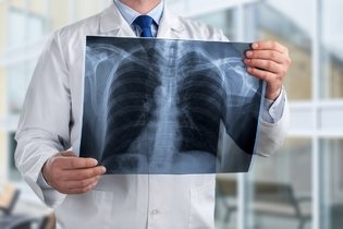 8 principais sintomas de tuberculose