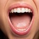 Candidiasis oral: síntomas, causas y tratamiento 