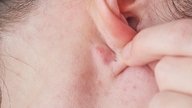 Lumps Behind the Ear: 6 Causes & When to See a Doctor