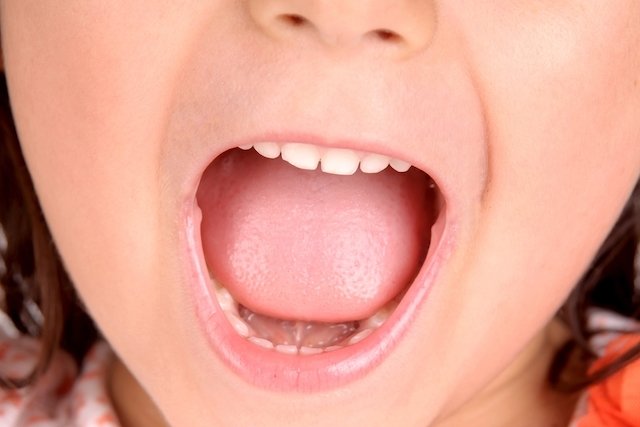 Imagem ilustrativa do artigo Quando devem cair os dentes de leite (e o que fazer)