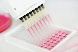 Imagem ilustrativa do artigo Captura híbrida HPV: o que é, para que serve e resultados
