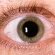 Ojos rojos: 9 causas y qué hacer