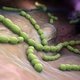 Streptococcus: o que é, tipos, como se pega e sintomas